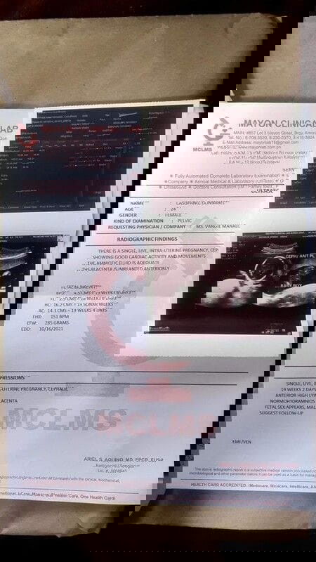 Hello mga ka mommy! 19 weeks preggy nakita agad gender ng baby ko 😁
