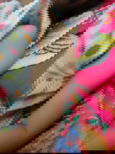 ลูกฉีดวัคซีน (4 ขวบ) แล้วแขนบวม ตัวร้อน เป็นอาการปกติหรือเปล่าคะ