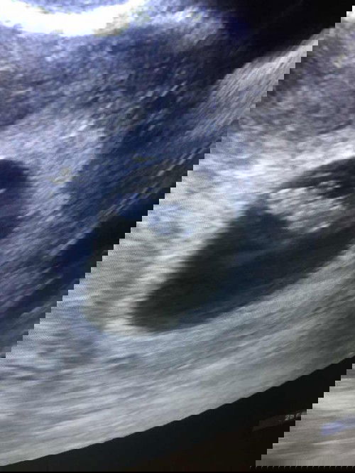 อัลตราซาวด์7w5d