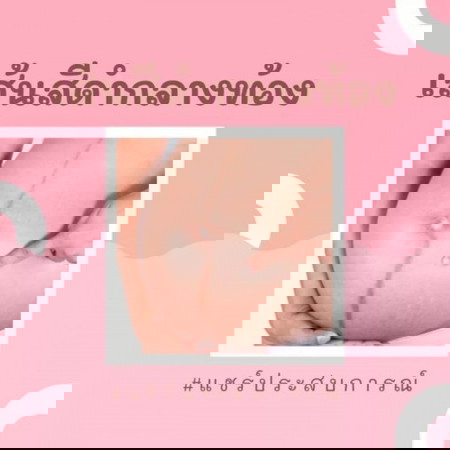 เส้นสีดำกลางท้อง มีใครเป็นบ้างคะ? 〰️