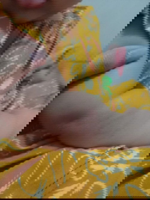 Merah² di Lengan Kanan dan Kiri