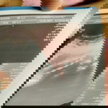 แม่จิตตกค่ะหมอ..