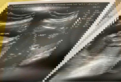 Baby Girl ultrasound