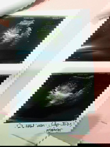 Adakah kandungan ini kembar???