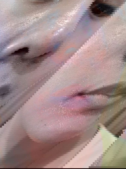 ตอนนี้ท้องได้ประมาณ 7week ค่ะ แต่หน้าแม่เริ่มพังมาก😂