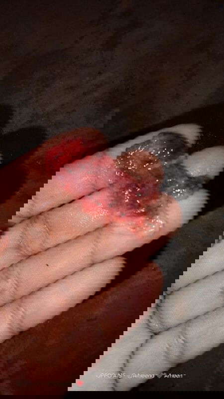 สอบถามผู้รู้หน่อยค่ะ ขออภัยในความไม่สุภาพน่ะค่ะ

มันคืออะไรคะหนูแท้งคุกคามค่ะ
8สัปดาห์+3วัน