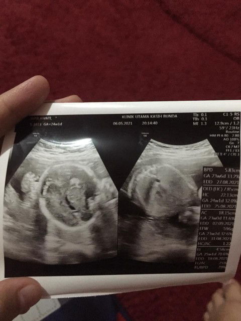 Info penambah darah alami