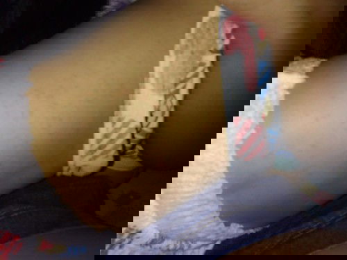 ขึ้นแบบนี้เป็นไข้อะไรคะ