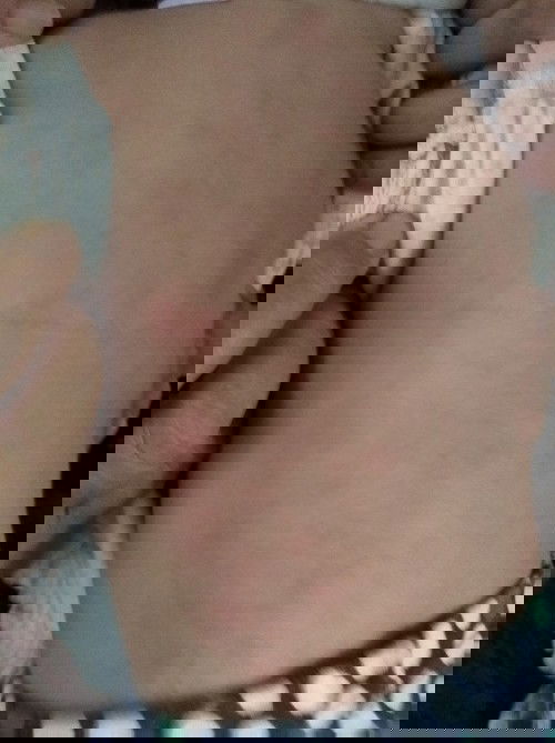 Naik merah" lepas kena suntik