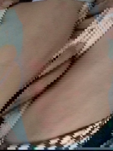 Naik merah" lepas kena suntik