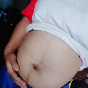 24 tuần nhờ mọi người đoán xem là trai hay gái ạ ❤️