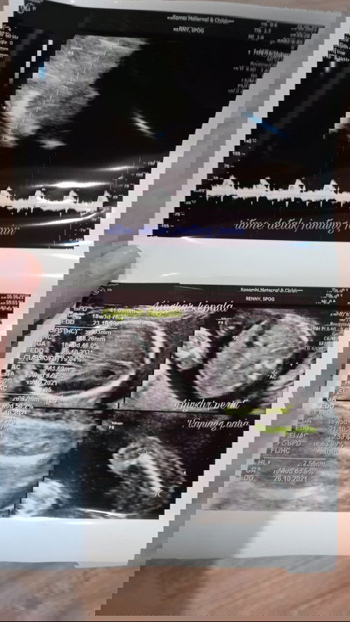 Hasil USG klinik USG kosambi graha raya bintaro