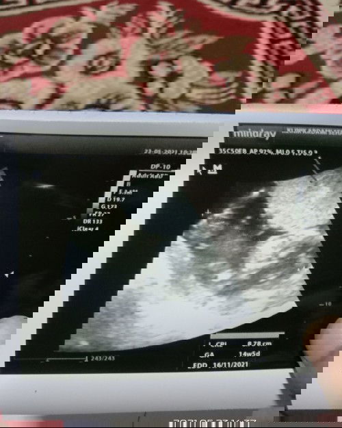 😇😇😇😇😇😇😇😇😇😇