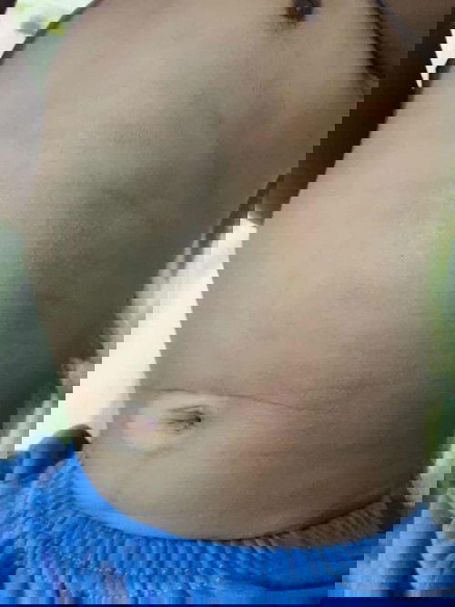 Kulit bayi 5bulan sensitif