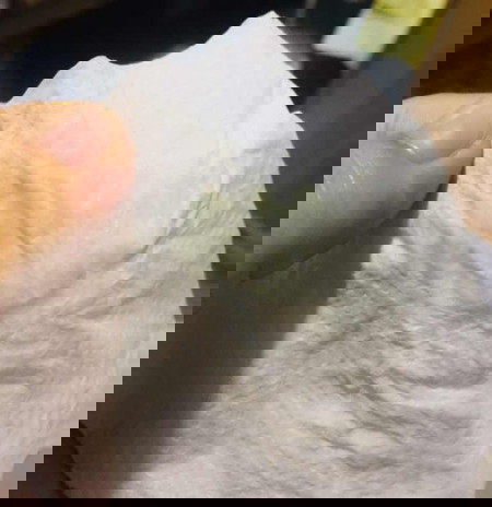 Discharge color pregnancy