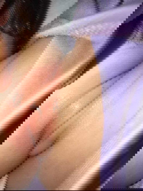 Leher bayi 1 bulan 17 hari merah atasinya gimana ya bun? #sharing