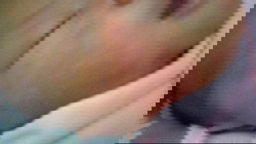 Pipi bayi baru lahir 4 hari kenapa merah gatel obatnya apa ya??