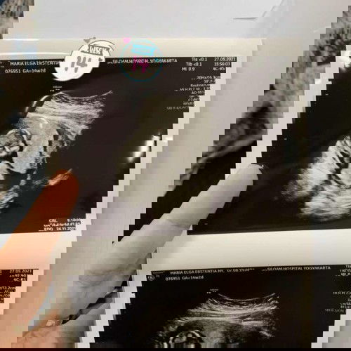 Hai Bund! USG 14weeks ♥️