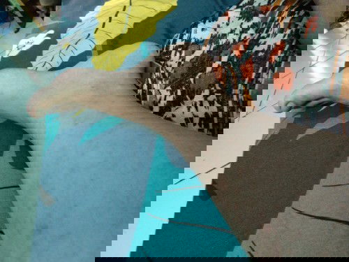 Apakah normal mau melahirkan badan gatal2 semua, terutama bag. Kaki?