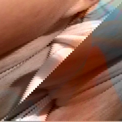 Moms salep untuk ruam karna asi apa yahh?