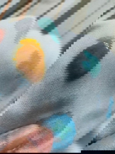 น้องถ่ายเป็นมูก