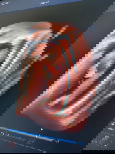 สอบถามแม่ๆค่ะ