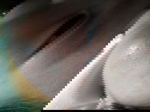 Muka seperti beruntusan