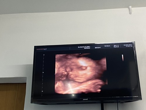 ทีมสิงหา ลูกดิ้นแรงไหมคะ