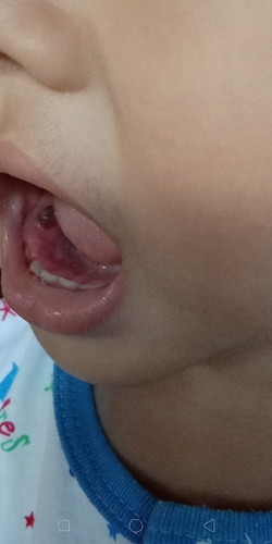 ขอคำปรึกษาหน่อยค่ะ