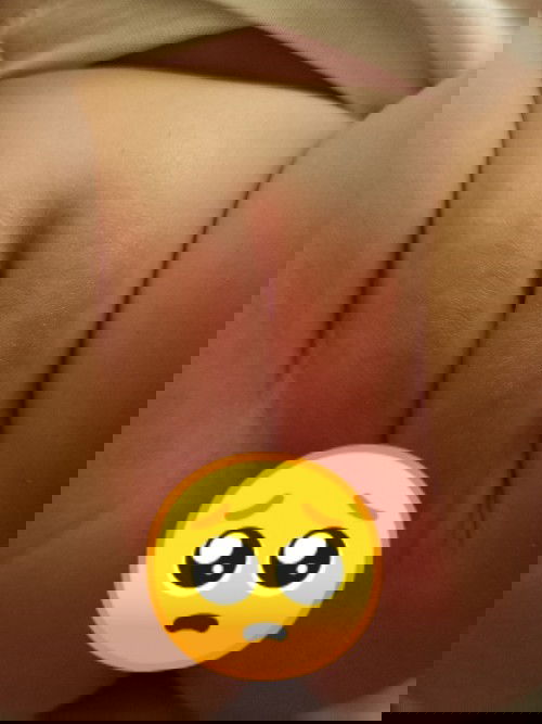 paano malalaman pag allergy si baby sa milk?