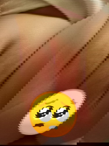 paano malalaman pag allergy si baby sa milk?