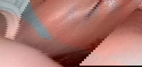 Bercak putih di wajah