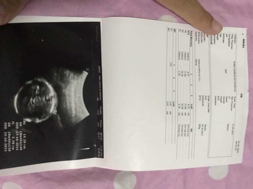 ช่วยดูหน่อยค่ะ