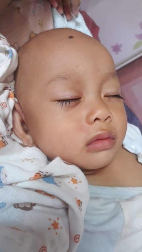 แพ้นมวัววววววววววววว