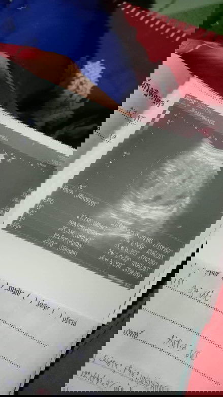 ได้รูปแบบนี้อีกแล้ว