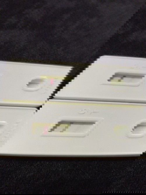 Pregnancy Journey of a APAS patient