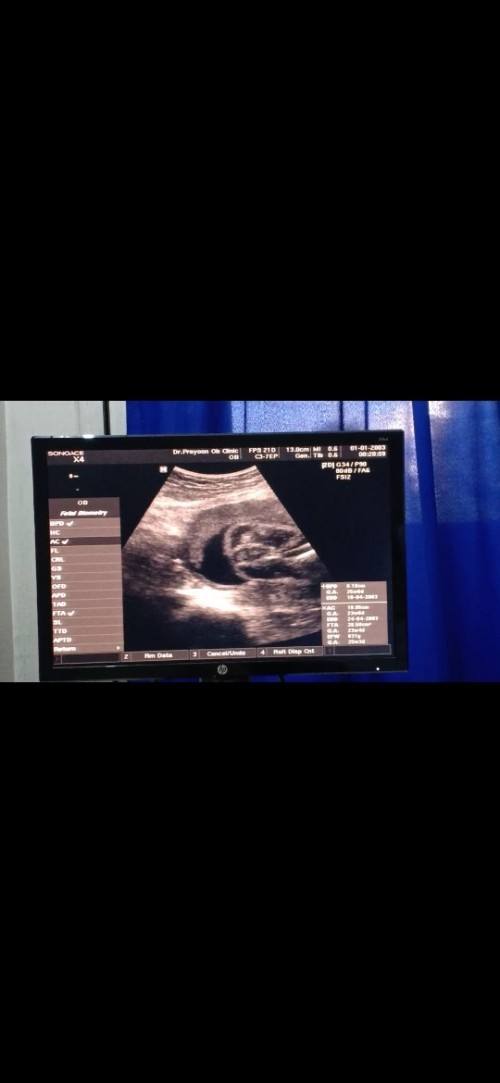 ไปซาวด์ดูเพศมาค่ะ