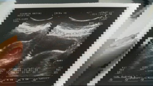 ภาพที่ฉันมีความสุขที่สุด