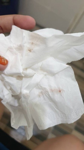 เล่ายาวหน่อยนะค่ะ ประจำเดือนมาน้อยแปลกๆ