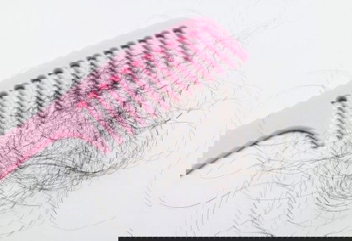 topic about Hair falls