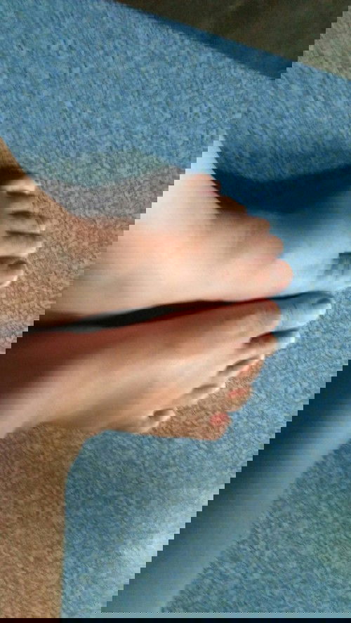 เท้าบวม+ฉี่เป็นฟอง