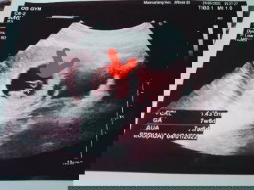 อยากสอบถามว่าที่ชี้ไว้คืออะไรค่ะ ช่วยบอกหน่อยคะไม่รุ้จริงๆคะ