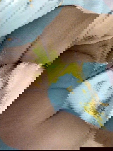 การขับถ่าย