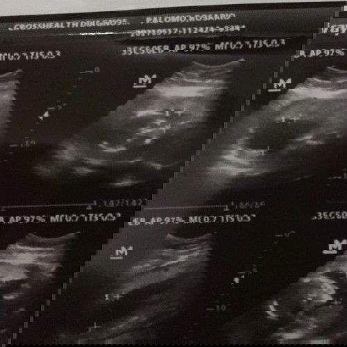 Ano po yung gender sa tingin nyo??