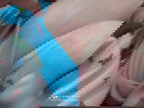 Muka merah dan gatal