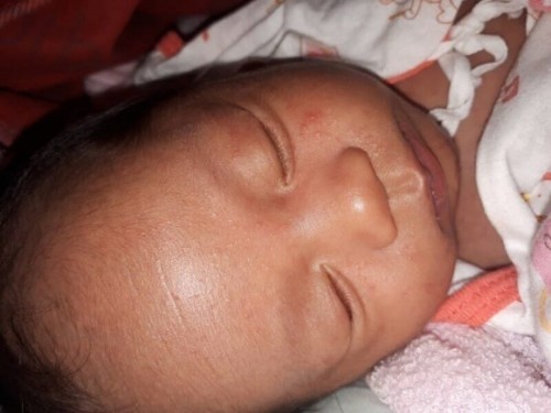 ผื่นแบบนี้เรียกว่าอาการเเพ้รึเปล่าคะ