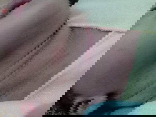 Obat ruam pada leher bayi 15 hari