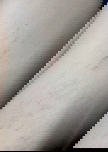 ควรไปหาหมอไหมคะ