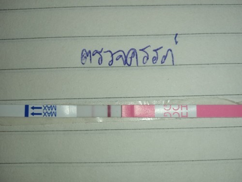การตั้งครรภ์