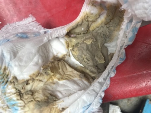 ask ko lang po mga mommy kung pkay lang po ba na ganito ang poop ng baby ko? 2years old na po siya turning 3 this july 4 po. Thankyou po sa sasagot.